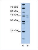 Anti-PDK4 antibody produced in rabbit affinity isolated antibody
