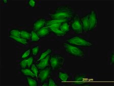 Monoclonal Anti-ENO3 antibody produced in mouse clone 5D1, purified immunoglobulin, buffered aqueous solution