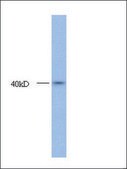Anti-HOXA10 antibody produced in rabbit IgG fraction of antiserum