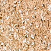 Anti-Neurofilament H Antibody, clone 7L2V7, Rabbit Monoclonal