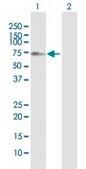 Anti-YTHDF2 antibody produced in mouse IgG fraction of antiserum, buffered aqueous solution