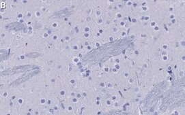 Anti-mGluR5 Antibody, clone 1F11 ZooMAb® Rabbit Monoclonal recombinant, expressed in HEK 293 cells