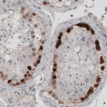 Monoclonal Anti-SSX2 antibody produced in mouse Prestige Antibodies&#174; Powered by Atlas Antibodies, clone CL3202, purified immunoglobulin, buffered aqueous glycerol solution