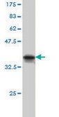 Monoclonal Anti-MARK2 antibody produced in mouse clone 3B12, purified immunoglobulin, buffered aqueous solution