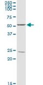 Anti-PPP2R2B antibody produced in rabbit purified immunoglobulin, buffered aqueous solution
