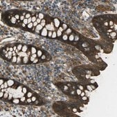 Anti-CHMP3 antibody produced in rabbit Prestige Antibodies&#174; Powered by Atlas Antibodies, affinity isolated antibody, buffered aqueous glycerol solution