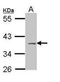 Anti-MC1R (C-terminal) antibody produced in rabbit affinity isolated antibody, buffered aqueous solution