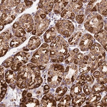 Anti-STK17A antibody produced in rabbit Prestige Antibodies&#174; Powered by Atlas Antibodies, affinity isolated antibody, buffered aqueous glycerol solution