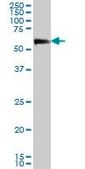 Monoclonal Anti-CAMKK2, (N-terminal) antibody produced in mouse clone 4C7, purified immunoglobulin, buffered aqueous solution