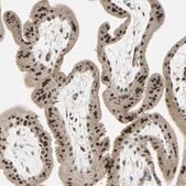 Anti-MED4 antibody produced in rabbit Prestige Antibodies&#174; Powered by Atlas Antibodies, affinity isolated antibody, buffered aqueous glycerol solution