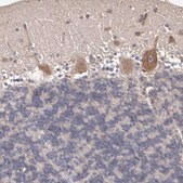 Anti-CXorf36 antibody produced in rabbit Ab1, Prestige Antibodies&#174; Powered by Atlas Antibodies, affinity isolated antibody, buffered aqueous glycerol solution
