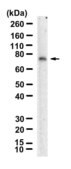 Anti-Merlin Antibody, clone 1H15-L1 ZooMAb® Rabbit Monoclonal recombinant, expressed in HEK 293 cells