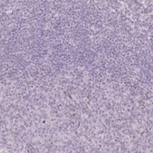 Anti-RASL10B antibody produced in rabbit Prestige Antibodies&#174; Powered by Atlas Antibodies, affinity isolated antibody, buffered aqueous glycerol solution
