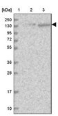 Anti-U2SURP antibody produced in rabbit Prestige Antibodies® Powered by Atlas Antibodies, affinity isolated antibody, buffered aqueous glycerol solution