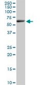 Anti-ELP3 antibody produced in mouse purified immunoglobulin, buffered aqueous solution