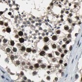 Anti-ELF2 antibody produced in rabbit Prestige Antibodies® Powered by Atlas Antibodies, affinity isolated antibody, buffered aqueous glycerol solution