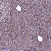 Anti-NSMF antibody produced in rabbit Prestige Antibodies&#174; Powered by Atlas Antibodies, affinity isolated antibody, buffered aqueous glycerol solution