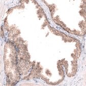 Monoclonal Anti-CLDN1 antibody produced in mouse Prestige Antibodies® Powered by Atlas Antibodies, clone CL3698, purified immunoglobulin, buffered aqueous glycerol solution
