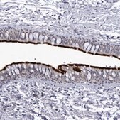 Anti-CCDC181 antibody produced in rabbit Prestige Antibodies&#174; Powered by Atlas Antibodies, affinity isolated antibody, buffered aqueous glycerol solution, ab3