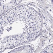 Anti-PRX antibody produced in rabbit Prestige Antibodies&#174; Powered by Atlas Antibodies, affinity isolated antibody, buffered aqueous glycerol solution