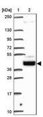 Anti-SOWAHD antibody produced in rabbit Prestige Antibodies® Powered by Atlas Antibodies, affinity isolated antibody, buffered aqueous glycerol solution