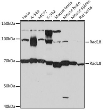 Anti-Rad18 Antibody, clone 9Y1H3, Rabbit Monoclonal