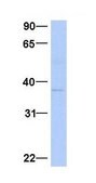 Anti-MAGEA4 antibody produced in rabbit affinity isolated antibody