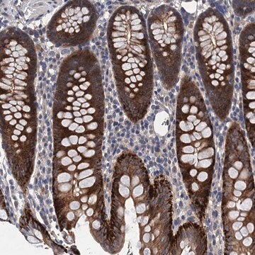 Anti-TRAF7 antibody produced in rabbit Prestige Antibodies&#174; Powered by Atlas Antibodies, affinity isolated antibody, buffered aqueous glycerol solution