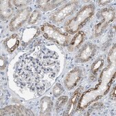Anti-MRS2 antibody produced in rabbit Prestige Antibodies&#174; Powered by Atlas Antibodies, affinity isolated antibody, buffered aqueous glycerol solution