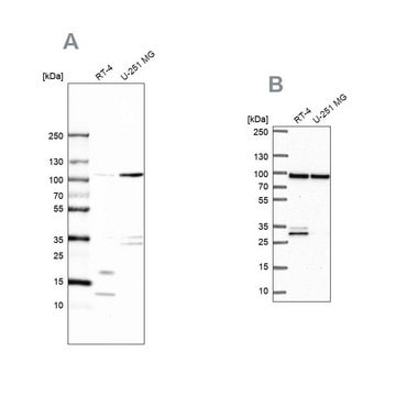 Anti-WDR48 antibody produced in rabbit Prestige Antibodies&#174; Powered by Atlas Antibodies, affinity isolated antibody, buffered aqueous glycerol solution