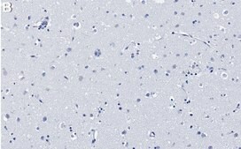 Anti-MCAM/CD146 Antibody, clone 1C21 ZooMAb&#174; Rabbit Monoclonal recombinant, expressed in HEK 293 cells