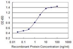 Monoclonal Anti-CABP4 antibody produced in mouse clone 3B3, purified immunoglobulin, buffered aqueous solution