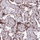 Anti-RB1 antibody produced in rabbit Prestige Antibodies® Powered by Atlas Antibodies, affinity isolated antibody, buffered aqueous glycerol solution