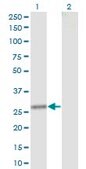 Monoclonal Anti-CLTA antibody produced in mouse clone 4D5, purified immunoglobulin, buffered aqueous solution