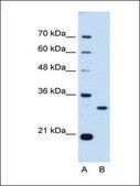 Anti-PSME3 (AB1) antibody produced in rabbit affinity isolated antibody