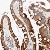 Anti-RPS6KC1 antibody produced in rabbit Prestige Antibodies&#174; Powered by Atlas Antibodies, affinity isolated antibody, buffered aqueous glycerol solution