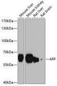Anti-AFP antibody produced in rabbit