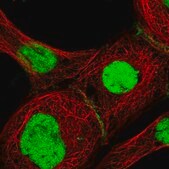 Anti-GTF2F1 antibody produced in rabbit Prestige Antibodies&#174; Powered by Atlas Antibodies, affinity isolated antibody, buffered aqueous glycerol solution