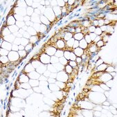 Anti-ENTPD5 antibody produced in rabbit
