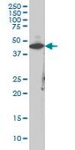 Monoclonal Anti-CKM antibody produced in mouse clone 1E3, purified immunoglobulin, buffered aqueous solution