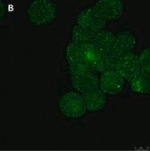Anti-ULBP-4/RAET1E Antibody, clone 6C10 ZooMAb&#174; Rabbit Monoclonal recombinant, expressed in HEK 293 cells