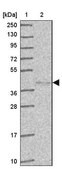 Anti-HYAL3 antibody produced in rabbit Prestige Antibodies&#174; Powered by Atlas Antibodies, affinity isolated antibody, buffered aqueous glycerol solution