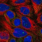 Anti-PXMP4 antibody produced in rabbit Prestige Antibodies® Powered by Atlas Antibodies, affinity isolated antibody, buffered aqueous glycerol solution