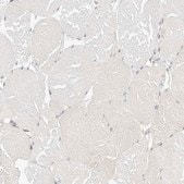 Anti-ATL1 antibody produced in rabbit Prestige Antibodies&#174; Powered by Atlas Antibodies, affinity isolated antibody, buffered aqueous glycerol solution