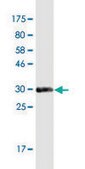 Monoclonal Anti-RNF170 antibody produced in mouse clone 2D6, purified immunoglobulin, buffered aqueous solution