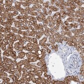 抗-BDH1 兔抗 Prestige Antibodies&#174; Powered by Atlas Antibodies, affinity isolated antibody, buffered aqueous glycerol solution