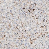 Anti-CECR1 antibody produced in rabbit Prestige Antibodies&#174; Powered by Atlas Antibodies, affinity isolated antibody, buffered aqueous glycerol solution