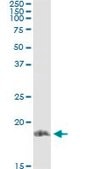 Monoclonal Anti-STMN1 antibody produced in mouse clone 3A9, ascites fluid