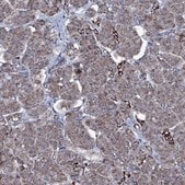 Anti-MRPS35 antibody produced in rabbit Prestige Antibodies&#174; Powered by Atlas Antibodies, affinity isolated antibody, buffered aqueous glycerol solution