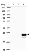 Anti-APOM antibody produced in rabbit Prestige Antibodies&#174; Powered by Atlas Antibodies, affinity isolated antibody, buffered aqueous glycerol solution